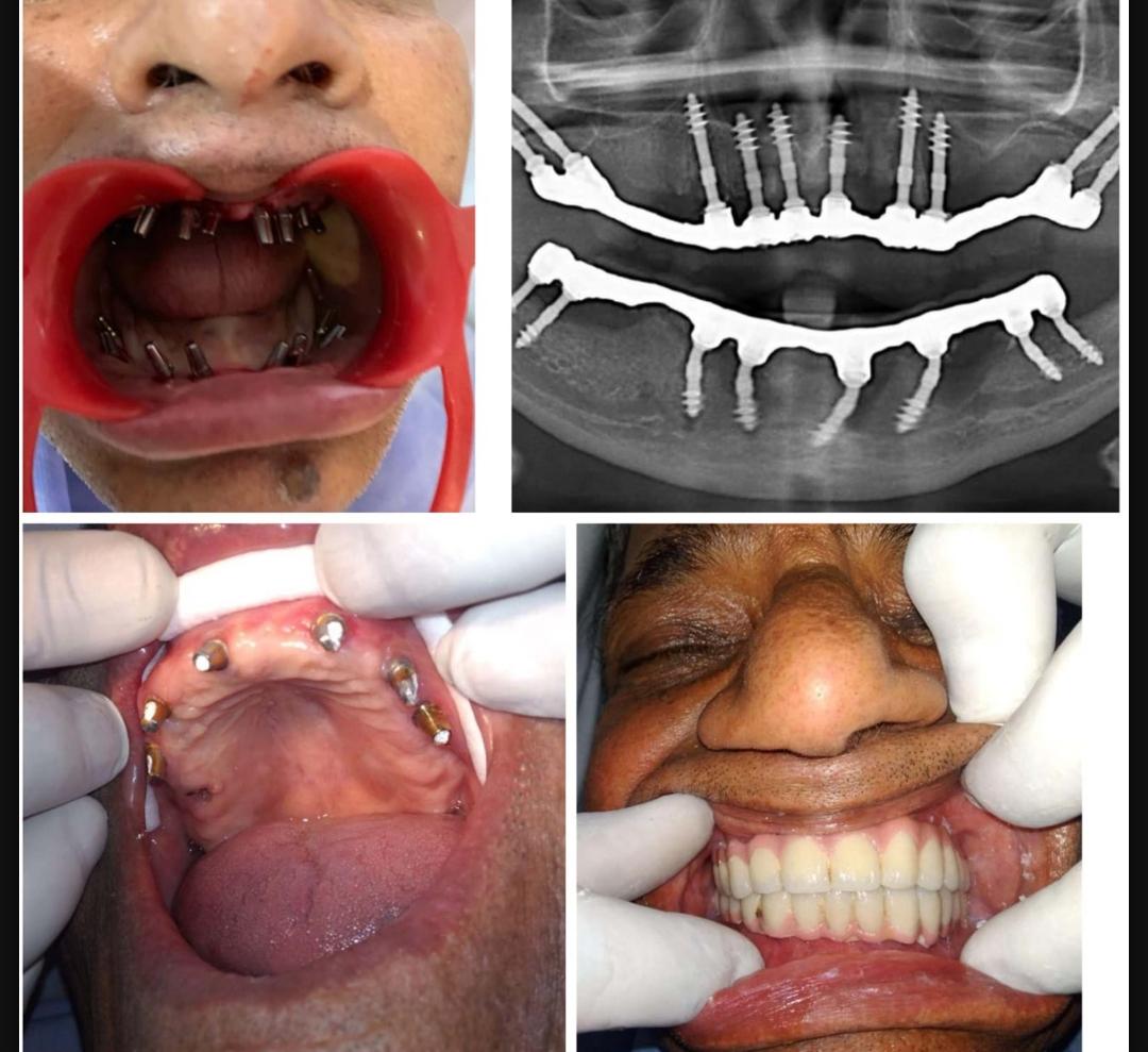 ALPHA DENTAL AND MAXILLOFACIAL CENTRE KANNANCHERY