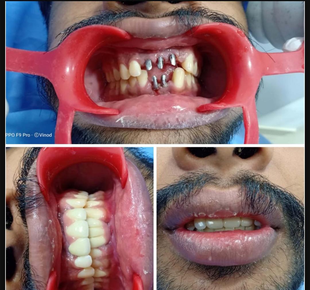 ALPHA DENTAL AND MAXILLOFACIAL CENTRE KANNANCHERY